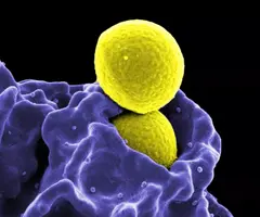 Yellow spheres of methicillin-resistant staphylococcus aureus.