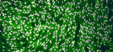 Small, round, purple and green uterine smooth muscle cells.