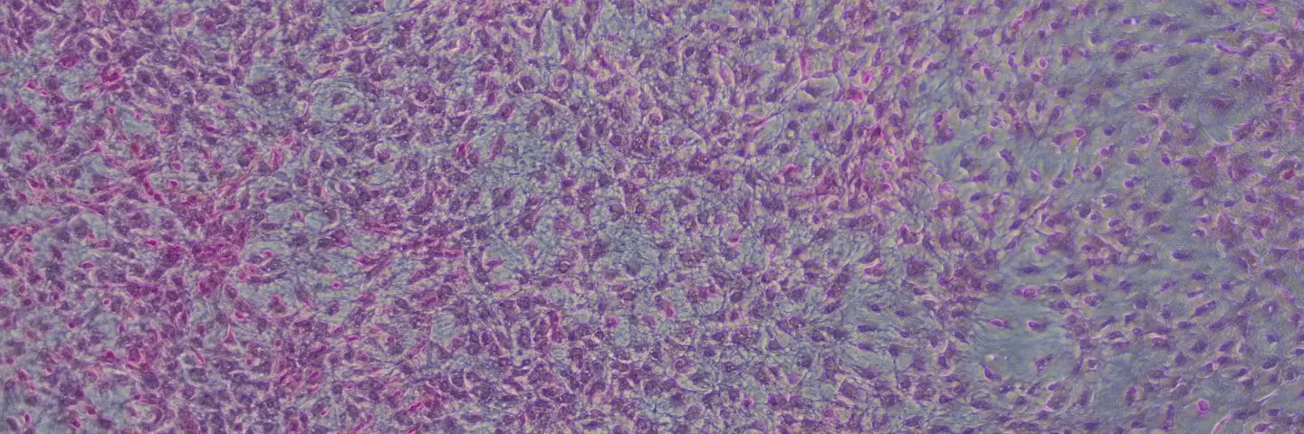 NIH3T3.2_typical monolayer, no foci_Stained_Day21.jpg