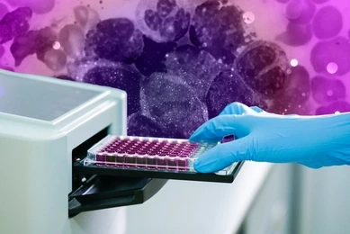 ELISA plate to measure OD with microplate reader. Microtiter plate (96 well) reader for biochemistry analysis.