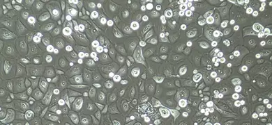 Gray and green corneal cells.