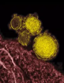 Highly magnified, digitally colorized transmission electron microscopic (TEM) image, reveals ultrastructural details exhibited by five, spherical shaped, Middle East respiratory syndrome coronavirus (MERS-CoV) virions, which were colorized yellow.