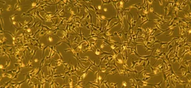 Fluorescent burnt-orange and gold, web-like cardiomyocyte cells.