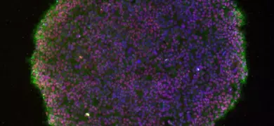 Fluorescent microscopy image of a dense colony of induced pluripotent stem cells with purple-stained nuclei and green-stained cell edges forming a circular cluster.