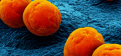 Orange balls of Streptococcus bacteria.