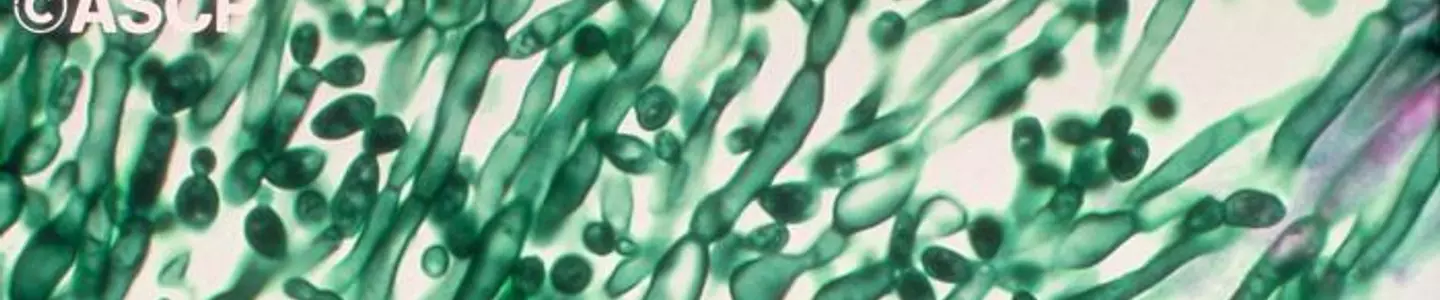 Candida albicans PHIL_1215_lores CDC_American Society of Clinical Pathologists.jpg