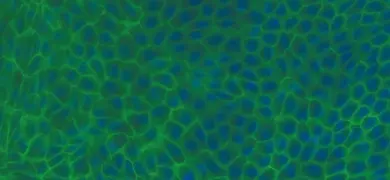 Green and blue connecting cells.