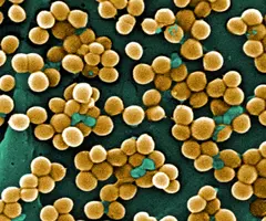 Yellow spheres of methicillin-resistant Staphylococcus aureus clustered together.