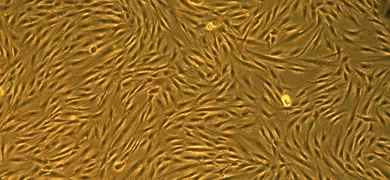Gold and black fibroblast cells.