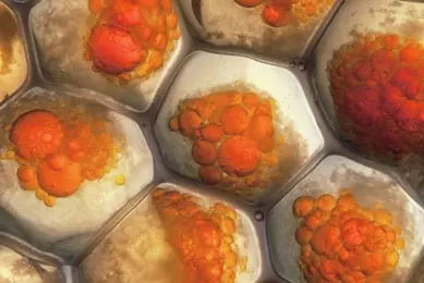 A color‑enhanced microscopic image shows tightly packed fat cells filled with clusters of orange and yellow lipid droplets. The polygon-shaped adipocytes appear swollen as the droplets occupy most of the internal space.