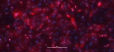 Fluorescent microscopy image of renal proximal tubular epithelial cells showing red-stained cytoskeletal structures and blue-stained nuclei, illustrating cellular morphology.
