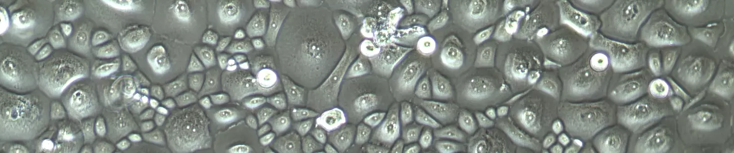 Gray and green corneal cells.
