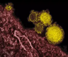 Highly magnified, digitally colorized transmission electron microscopic (TEM) image, reveals ultrastructural details exhibited by five, spherical shaped, Middle East respiratory syndrome coronavirus (MERS-CoV) virions, which were colorized yellow.