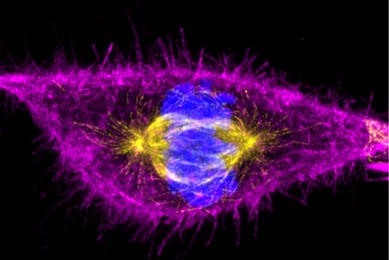 Super-resolution image of a fixed hTERT-RPE1 cell in mitosis, showing the interaction between actin (magenta) and microtubules (red). The image is displayed as a maximum intensity projection from NSPARC stacks.