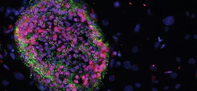 Purple and green induced pluripotent stem cells.