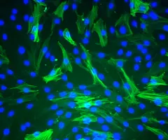 Fluorescent green and blue aortic smooth muscle cells.