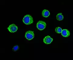 Fluorescent blue and green spheres of leukemic cells.