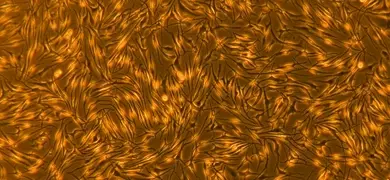 Microscopic image showing a dense cluster of small, long, thin, yellow and brown melanocyte cells with intricate patterns and structures.