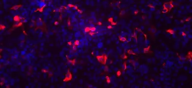 Fluorescent blue and red colon cells.