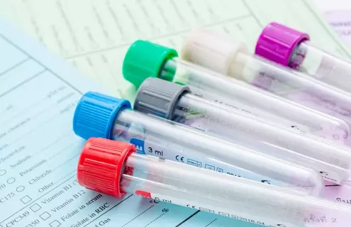 Empty test tubes with caps of various colors laying on top of medical forms.