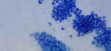 Photomicrograph reveals some of the ultrastructural morphology exhibited by the fungal organism, Candida albicans, which lives on numerous parts of the human body, as normal flora