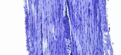 Microscopic image of skeletal muscle tissue in transverse section, showing elongated, striated muscle fibers with multiple nuclei stained in blue.