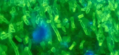 A fluorescent antibody (FA) stained tissue sample, extracted from a patient with a case of candidiasis, due to a Candida sp. fungal organism