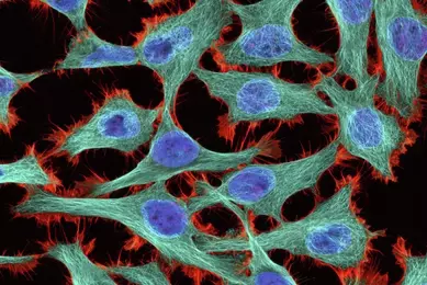 HeLa+cells-III+TJD.jpg