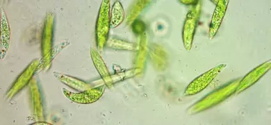 Bright green, translucent eukaryotic algal flagellates under a microscope.