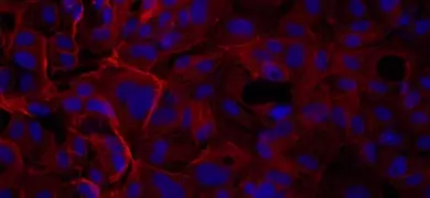 Red and blue phalloidin human umbilical vein endothelial cells.