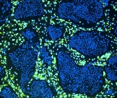  Green and blue conditionally reprogrammed organoid cells