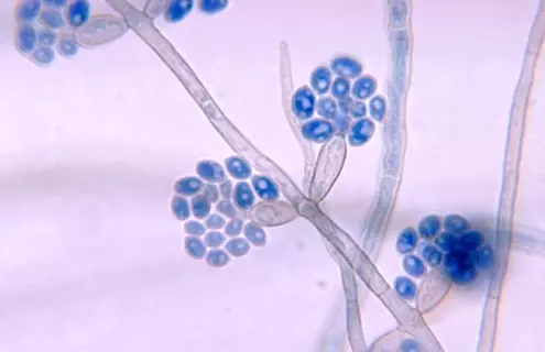 Translucent stems and blue, flower-like clusters of Exophiala salmonis.