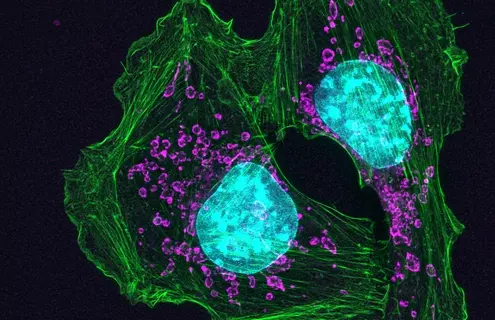 Purple and green top mouse skin cancer cells.