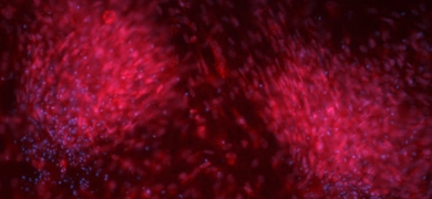 Fluorescent microscopy image showing clusters of neural progenitor cells stained pink with DAPI-stained blue nuclei, associated with Parkinson’s disease research.