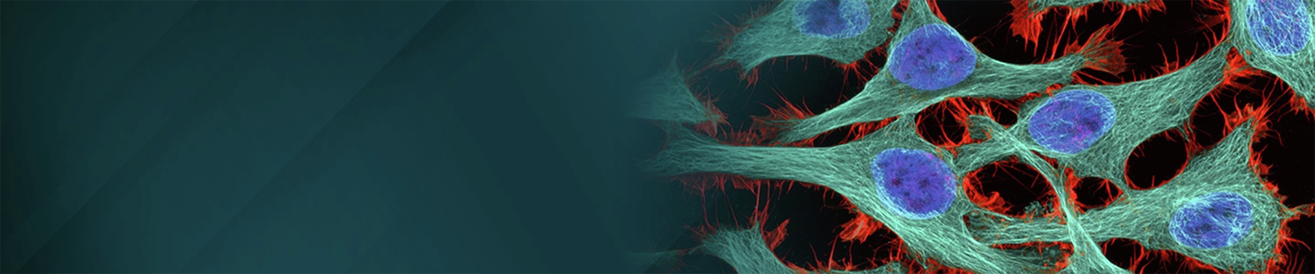 A banner image shows elongated adherent cells with teal filamentous cytoskeletal networks and bright bluish‑purple nuclei connected across the right side, with thin red actin‑like fibers interwoven, set against a dark teal gradient background on the left.