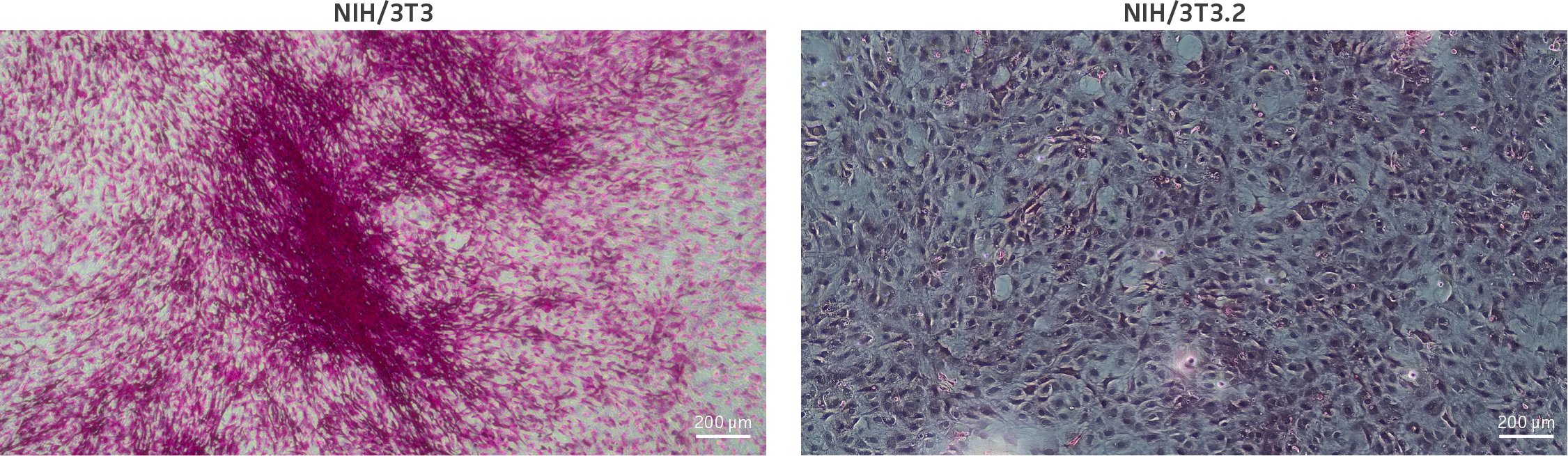 Evaluation of growth foci in parental and clonal derivative cells following carbol-fuchsin staining. The parental NIH/3T3 cell line demonstrated high evidence of foci formation. The NIH/3T3.2 clonal derivative presented here demonstrated negative growth foci.