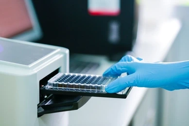 ELISA plate to measure OD with microplate reader. Microtiter plate (96 well) reader for biochemistry analysis.