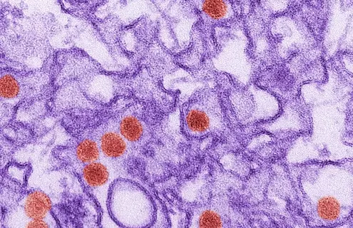 Purple tendrils and red spheres of the Zika virus.