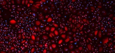 Red and blue gingival keratinocytes.