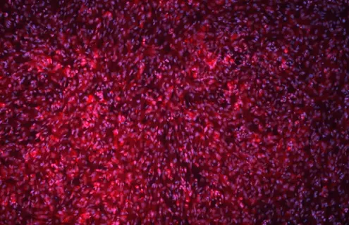 Pink and blue Parkinsons cells.
