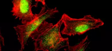 Fluorescent red and yellow-green non-small cell lung cancer cells.