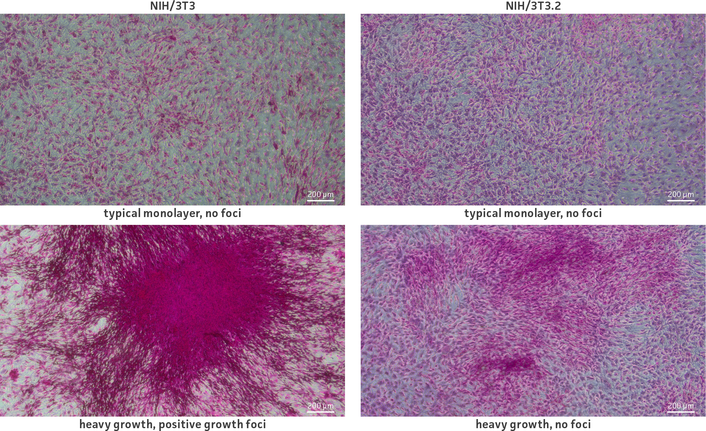 Contact inhibition testing comparison of the parental and clonal derivative. Typical monolayer growth areas can be seen in both cell lines (top). With heavier growth (bottom), the parental cell line demonstrates positive growth foci formation while the clonal derivative cell line demonstrates negative foci formation.