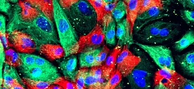 Fluorescent green, blue, and red prostate cancer organoid xenograft.