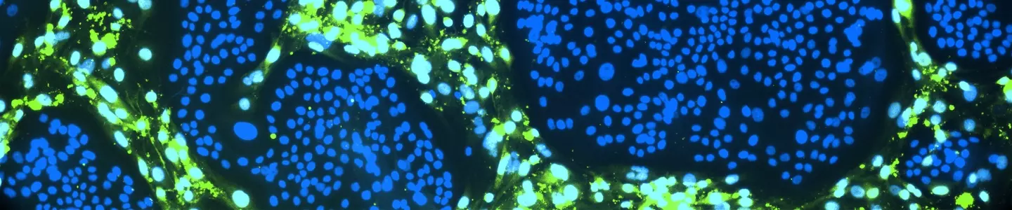  Green and blue conditionally reprogrammed organoid cells
