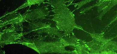 Green loose cadherin adhesions in cultured melanoma cells
