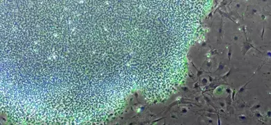 Blue and gray embryonic induced pluripotent stem cells.