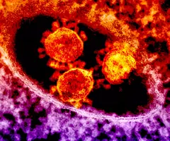 Grainy, red-orange and purple spheres of Middle East respiratory syndrome coronavirus.