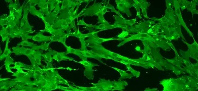 Green mesenchymal IPS stem cells.