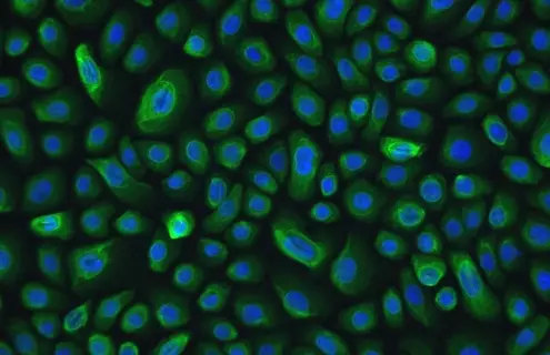 Green and blue NuLi lung epithelial small airway cells.
