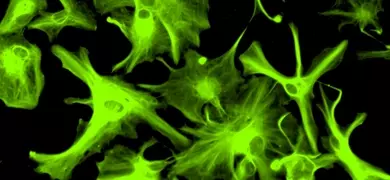 Fluorescent green oligodendrocytes neural progenitor cells are shown against a black background. The cells have various shapes and sizes, with some displaying branching structures and others appearing more rounded.